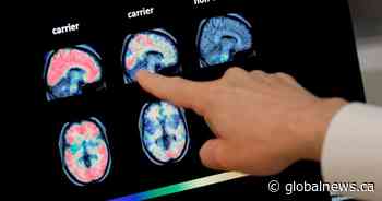 New research shows physical touch could slow onset of Alzheimer’s disease