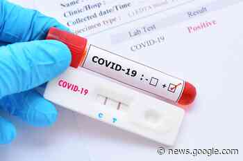 Guarapuava confirmou 30 casos de Covid-19 na última semana ... - Correio do CIdadão