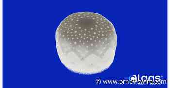 Conformal Medical Announces Positive One-Year Data from its Left Atrial Appendage Closure Performed Under Conscious Sedation Study