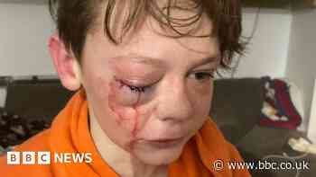 Neath Port Talbot: Boy, 12, left traumatised after park attack