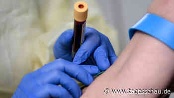 Weltkrebstag: Wann kommt der Bluttest auf Krebs?