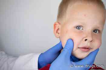 Measles Outbreak Over in Ohio