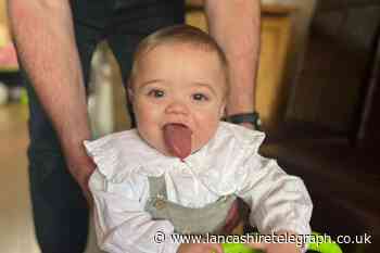 Feniscowles: Mum raising money for baby's tongue reduction surgery