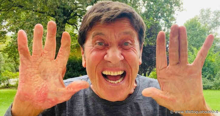 Sanremo 2023, Gianni Morandi: come sono le sue mani ustionate dopo l’incidente. Il post: “Voglia di urlare”