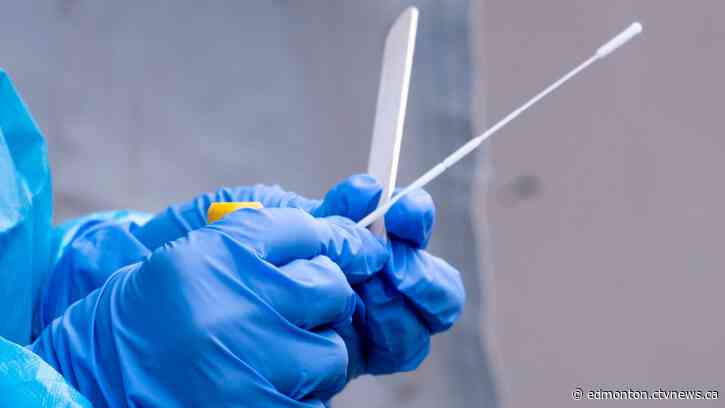 Alberta COVID-19 hospitalizations below 700, 24 deaths added