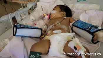 'Like a fairy tale': 10-month-old Toronto baby with rare liver disease saved by anonymous donor