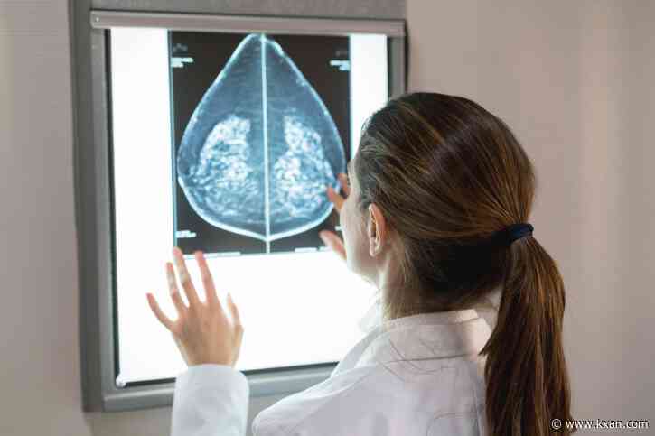 Breast density is a greater risk for breast cancer than many think, study finds