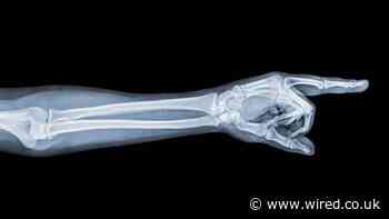 North Korean Hackers Are Attacking US Hospitals