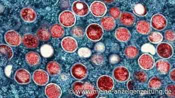 Affenpocken-Ausbruch bleibt Gesundheitsnotstand