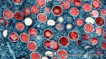 Affenpocken-Ausbruch bleibt Gesundheitsnotstand