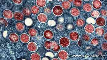 WHO: Affenpocken-Ausbruch bleibt Gesundheitsnotstand