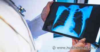 The 5 common cancers that are easy to miss, according to top doctor