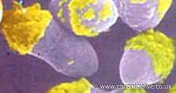 Newcastle University professor helps write UN study on superbugs