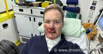 TV presenter Dan Walker 'glad to be alive' after being hit by car while riding bike