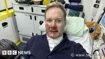 Dan Walker: TV presenter injured in bicycle crash