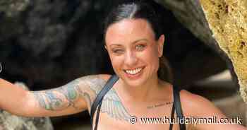 Woman has an extremely rare condition that links her eyelids to her jaw - which causes her eyes to droop when she opens and closes her mouth