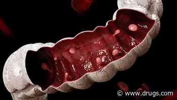 Cold Versus Hot Snare Polypectomy Cuts Risk for Delayed Bleeding