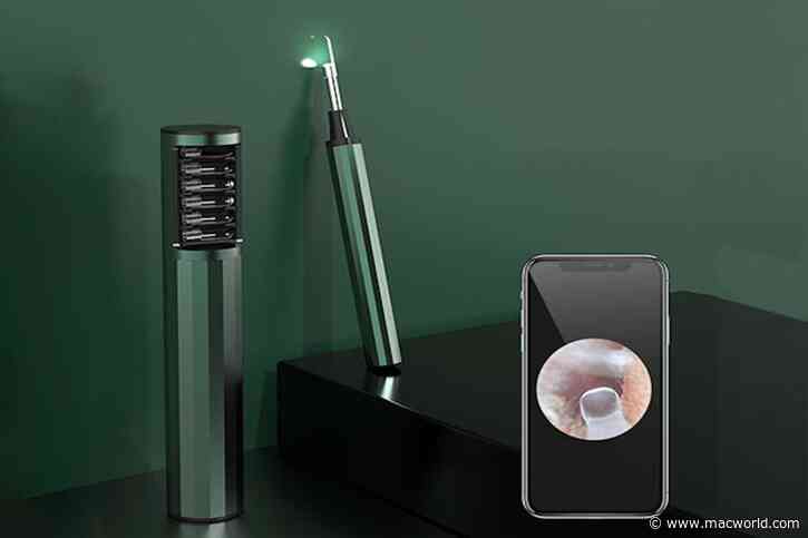Remove earwax the high-tech way with this $29.95 camera tool