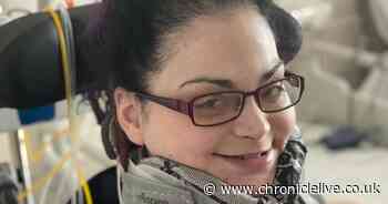 Cramlington woman with rare condition leaves hospital following major operation to save her life