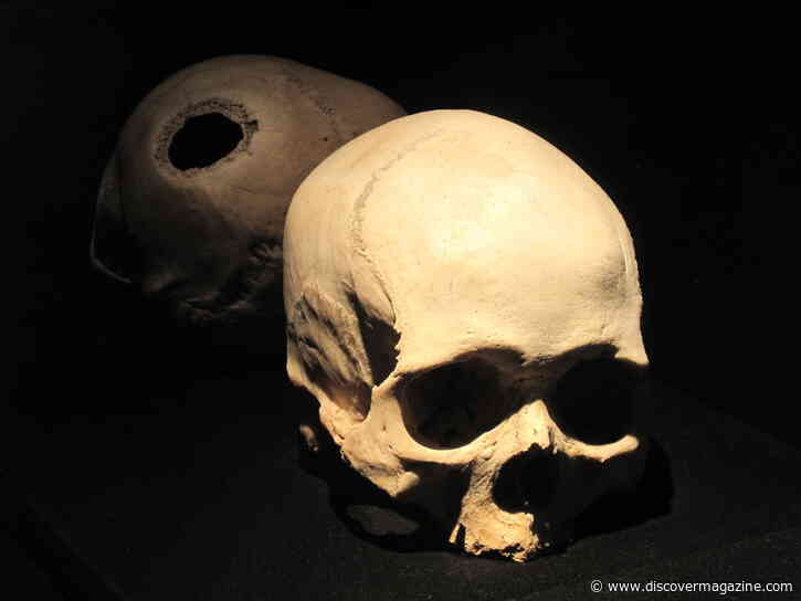 The Upsetting World of Primitive Brain Surgery