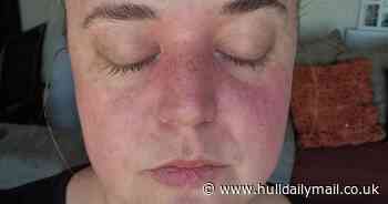 Woman diagnosed with rare brain condition which caused eyes to "switch off"