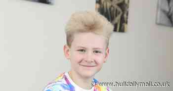 Boy, aged 10, gets stopped in the street due to his 'weird and wiry' hair caused by rare condition
