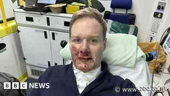 Dan Walker on bike accident: 'My whole body aches'