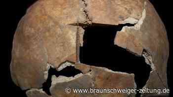 Späte Bronzezeit: Mann vor 3500 Jahren am Schädel operiert