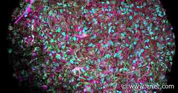 AI Could Be Made Obsolete by 'Biocomputers' Running on Human Brain Cells     - CNET