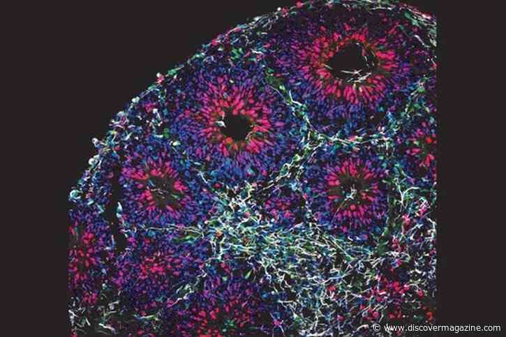 Artificial Brains May Pose a Startling Ethical Dilemma