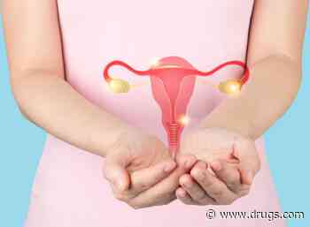 Lifetime Ovulatory Years Linked to Epithelial Ovarian Cancer