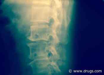 Spinal Cord Stimulation May Ease Diabetic Neuropathy