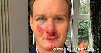 Dan Walker says when he'll be back on TV after bike crash