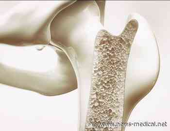 Research identifies a possible treatment strategy for rare bone marrow failure syndrome