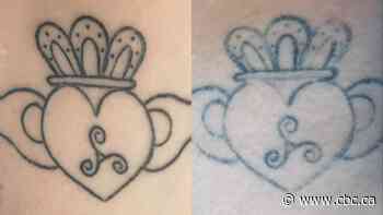 Tattoos that will be 'gone in a year'? Not so much, say regretful customers