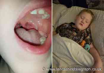Blackburn mum says GP won't refer son for tonsillitis