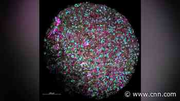 Human brain-powered computers could be the way of the future