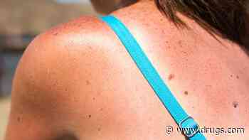 Timing of Melanoma Immunotherapy Could Be Key to Outcomes: Study