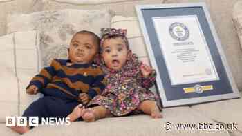 Canadian siblings certified as world's most premature twins
