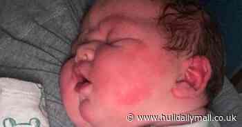 'When I gave birth every doctor in the room gasped at my baby's 'giant' size'