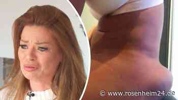 Schönheits-OP-Marathon: DSDS-Star nach acht Po-Eingriffen am Ende