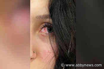 ‘She was a beast’: Shuswap women recovering after alleged assault by unknown driver