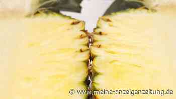 Fettleber: Acht Lebensmittel, auf die man besser verzichten sollte