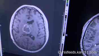 Brain cancer drug trial set to expand two years after saving MN mother