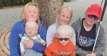 Hebburn mum pleads with strangers to stop 'nasty' remarks about her children with albinism
