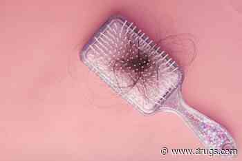 Hair Regrowth Seen in Alopecia With Methotrexate + Prednisone