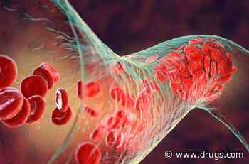 Use of Vena Cava Filters in VTE Patients Is Safe, Effective