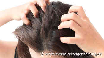 Die richtige Kopfhautpflege befreit Sie von Juckreiz und Schuppen