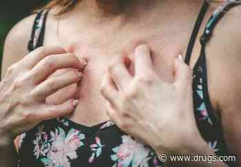 New Drug Could Be Treatment Option for People With Eczema