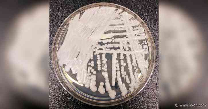 Austin Public Health says deadly fungus spreading in the U.S. is a ‘top threat’